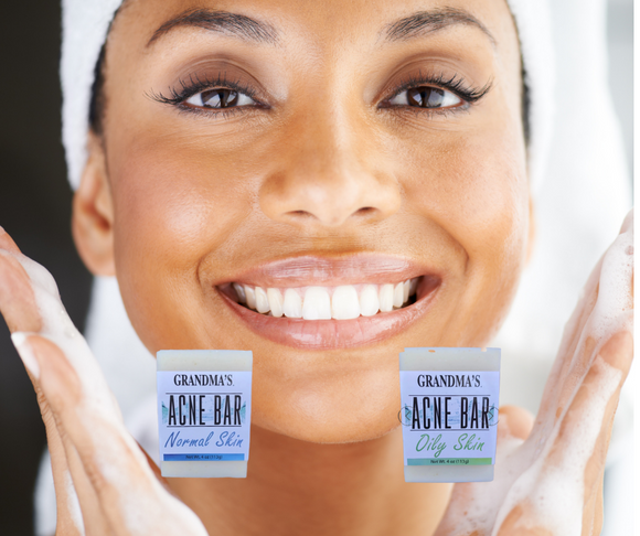 GRANDMA'S Acne Bar for Normal Skin or Oily Skin, 4.0 oz.